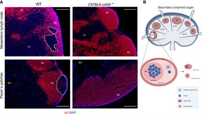 Elevated levels of enteric IgA in an unimmunised mouse model of Hyper IgM syndrome derived from gut-associated secondary lymph organs even in the absence of germinal centres